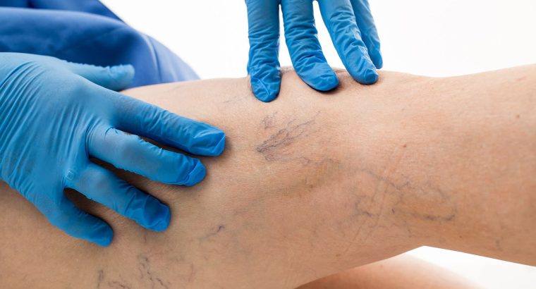 بهترین متخصص واریس اصفهان | دکتر مهرداد طاهریون