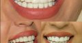 بهترین دندانپزشک اصفهان | دکتر پیام توکلی