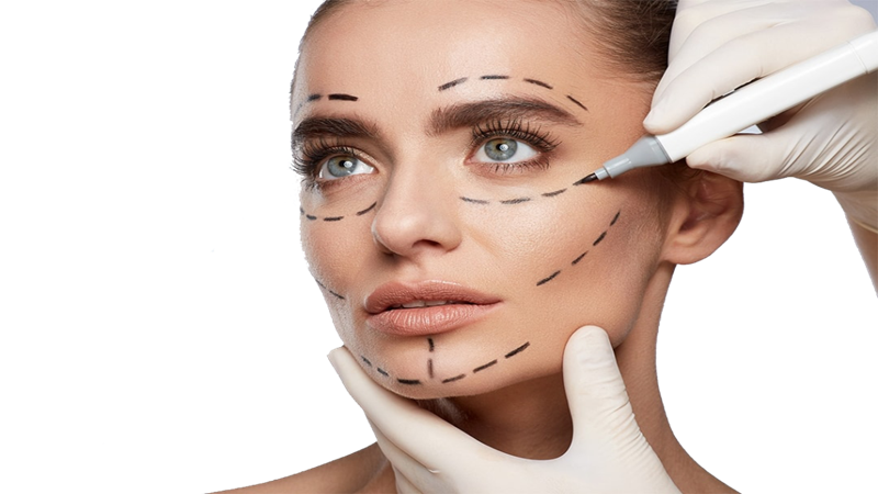 لیفت با نخ در اصفهان