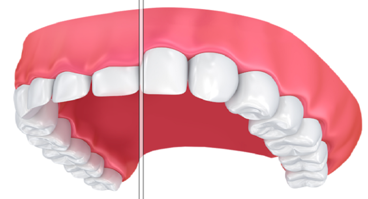 بهترین جراح لیفت لثه اصفهان