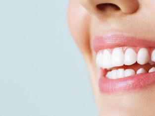 بلیچینگ دندان اصفهان – دکتر حسین برجیان