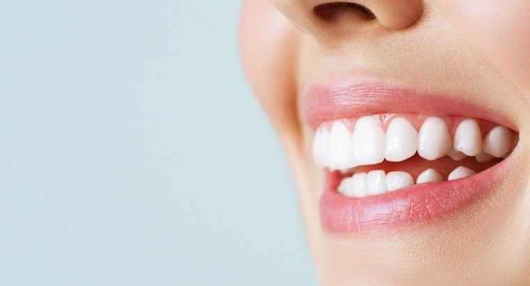 بلیچینگ دندان اصفهان – دکتر حسین برجیان