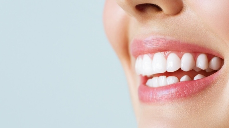 بلیچینگ دندان اصفهان – دکتر حسین برجیان